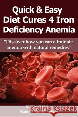 Anemia: Iron Deficiency Diet: Large Print: Quick and Easy Diet Cures For Anemia Silva, Rudy Silva 9781492919896