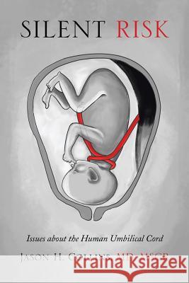 Silent Risk: Issues about the Human Umbilical Cord Collins, Jason H. Mscr 9781493114634