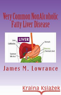 Very Common NonAlcoholic Fatty Liver Disease: How To Know if You Have Hepatic Steatosis Lowrance, James M. 9781493524471 Createspace