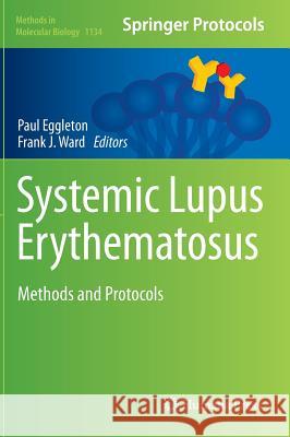 Systemic Lupus Erythematosus: Methods and Protocols Eggleton, Paul 9781493903252