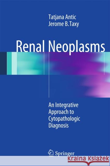 Renal Neoplasms: An Integrative Approach to Cytopathologic Diagnosis Antic, Tatjana 9781493904303