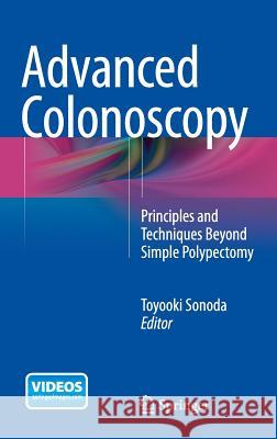 Advanced Colonoscopy: Principles and Techniques Beyond Simple Polypectomy Sonoda, Toyooki 9781493915835 Springer