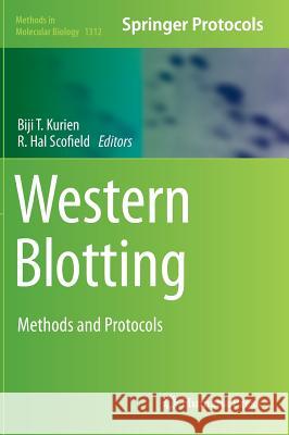 Western Blotting: Methods and Protocols Kurien, Biji T. 9781493926930 Humana Press