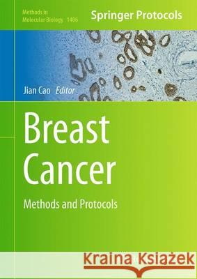 Breast Cancer: Methods and Protocols Cao, Jian 9781493934423