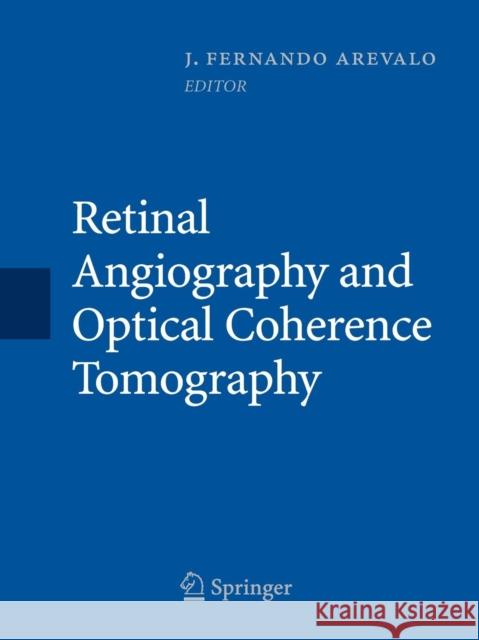 Retinal Angiography and Optical Coherence Tomography J. Fernando Arevalo 9781493938841 Springer