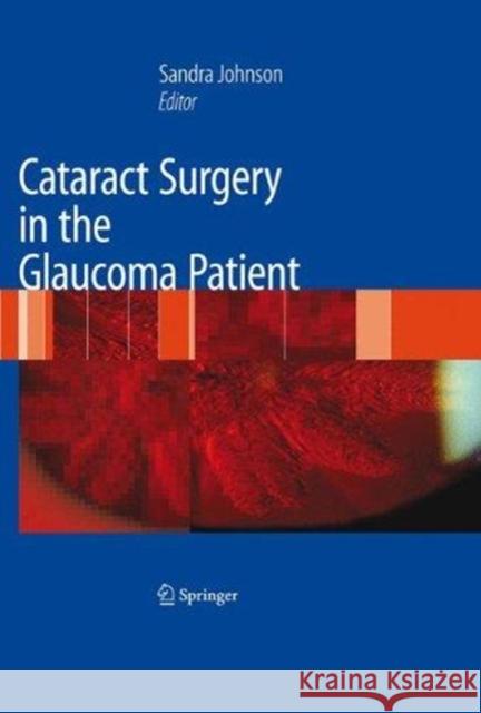 Cataract Surgery in the Glaucoma Patient Sandra M. Johnson 9781493939183 Springer