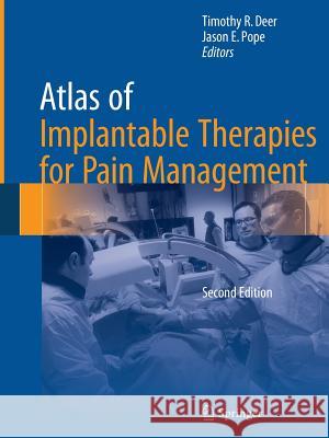 Atlas of Implantable Therapies for Pain Management Timothy R. Deer Jason E. Pope 9781493939497