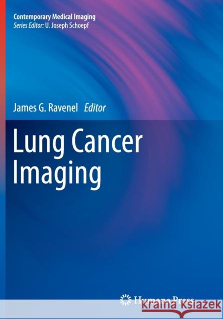 Lung Cancer Imaging James G. Ravenel 9781493940684 Humana Press