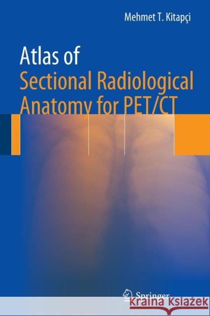 Atlas of Sectional Radiological Anatomy for Pet/CT Kitapci, Mehmet T. 9781493940912 Springer