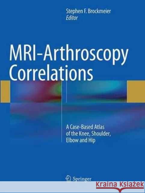 Mri-Arthroscopy Correlations: A Case-Based Atlas of the Knee, Shoulder, Elbow and Hip Brockmeier, Stephen F. 9781493945399 Springer