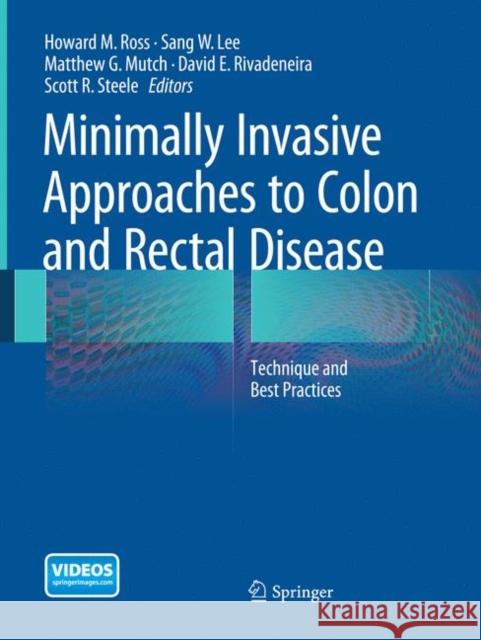 Minimally Invasive Approaches to Colon and Rectal Disease: Technique and Best Practices Ross MD Facs Fascrs, Howard M. 9781493947485 Springer