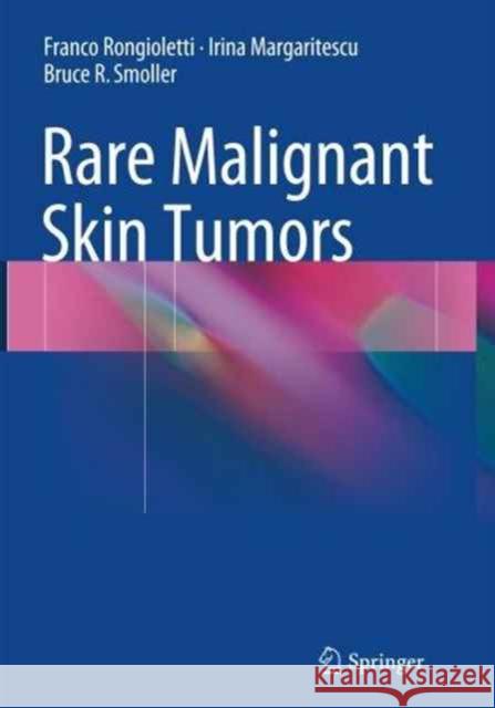 Rare Malignant Skin Tumors Franco Rongioletti Irina Margaritescu Bruce R. Smoller 9781493948260 Springer