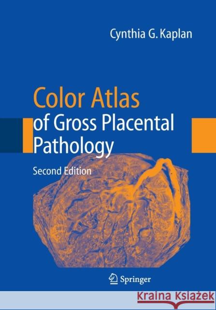 Color Atlas of Gross Placental Pathology Cynthia G. Kaplan 9781493950355 Springer