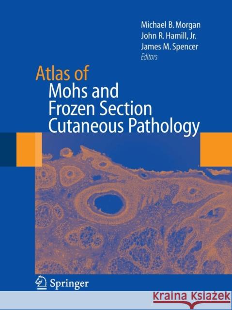 Atlas of Mohs and Frozen Section Cutaneous Pathology Michael Morgan John R. Hamill James M. Spencer 9781493950683 Springer