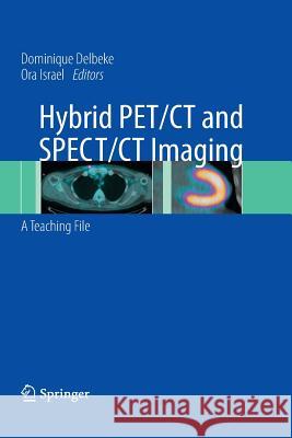 Hybrid PET/CT and SPECT/CT Imaging: A Teaching File Delbeke, Dominique 9781493950744