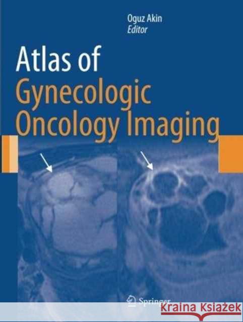 Atlas of Gynecologic Oncology Imaging Oguz Akin 9781493951574 Springer