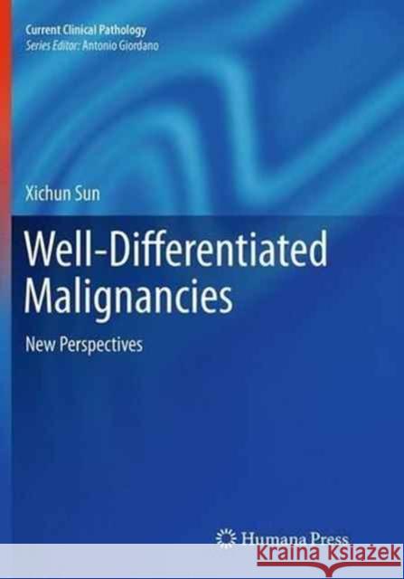 Well-Differentiated Malignancies: New Perspectives Sun, Xichun 9781493952670 Humana Press
