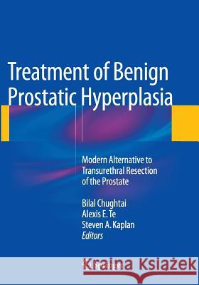 Treatment of Benign Prostatic Hyperplasia: Modern Alternative to Transurethral Resection of the Prostate Bilal Chughtai Alexis E. Te Steven a. Kaplan 9781493955220 Springer