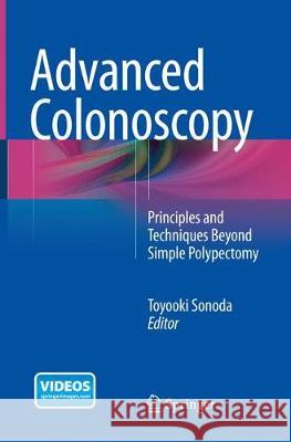 Advanced Colonoscopy: Principles and Techniques Beyond Simple Polypectomy Sonoda, Toyooki 9781493955435 Springer