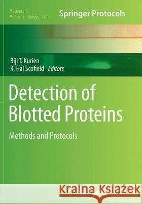 Detection of Blotted Proteins: Methods and Protocols Kurien, Biji T. 9781493955954 Humana Press