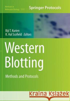 Western Blotting: Methods and Protocols Kurien, Biji T. 9781493955961 Humana Press