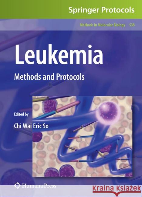 Leukemia: Methods and Protocols So, Chi Wai Eric 9781493956302 Humana Press