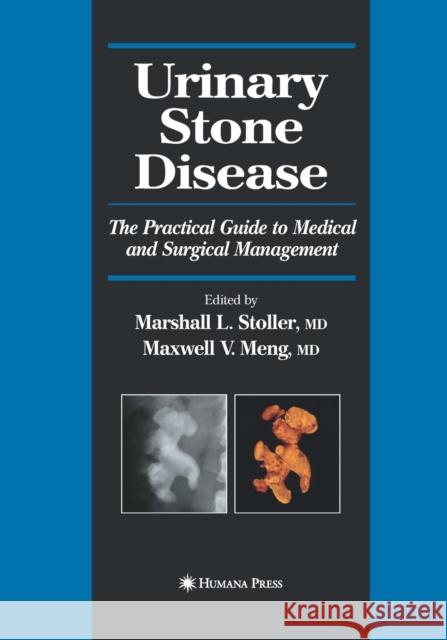 Urinary Stone Disease: The Practical Guide to Medical and Surgical Management Stoller, Marshall L. 9781493956418 Humana Press