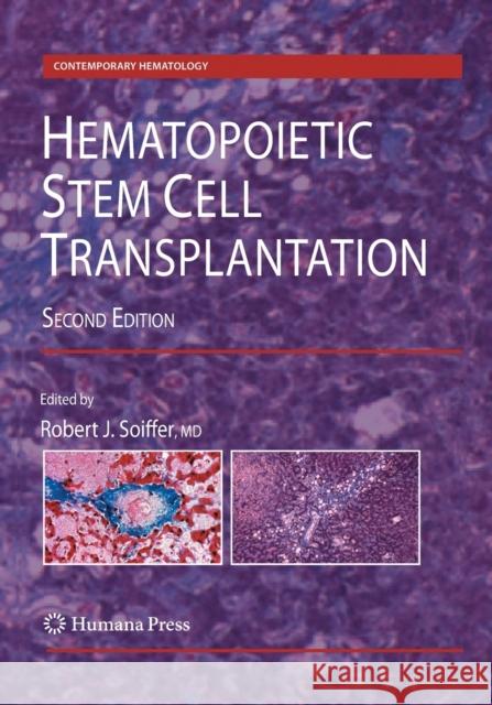 Hematopoietic Stem Cell Transplantation Robert J. Soiffer 9781493956456 Humana Press