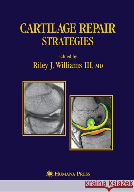Cartilage Repair Strategies Riley J. Williams L. Peterson B. J. Cole 9781493956562 Humana Press