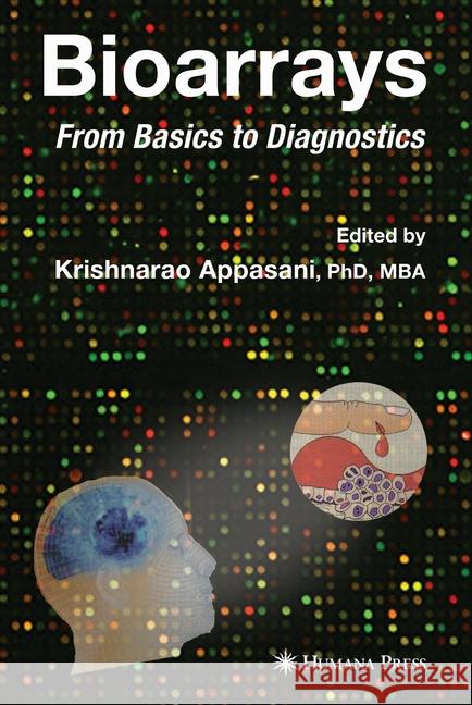 Bioarrays: From Basics to Diagnostics Southern, Sir E. M. 9781493956722 Humana Press