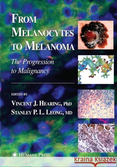 From Melanocytes to Melanoma: The Progression to Malignancy Hearing, Vincent J. 9781493956746