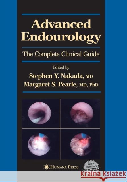 Advanced Endourology: The Complete Clinical Guide Nakada, Stephen Y. 9781493956784