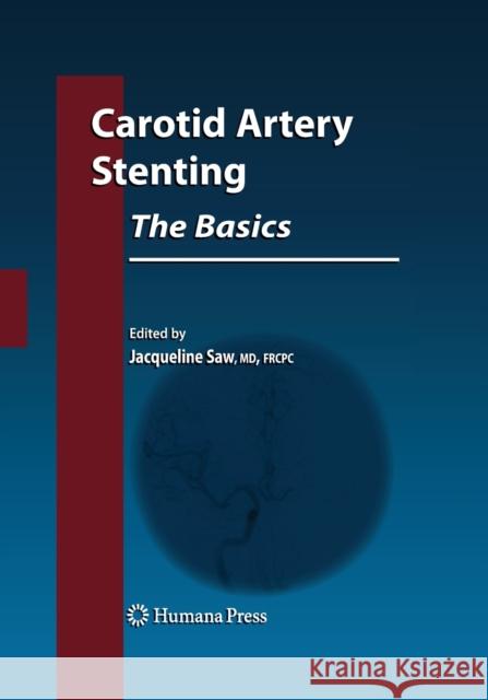 Carotid Artery Stenting: The Basics Jacqueline Saw 9781493956876 Humana Press