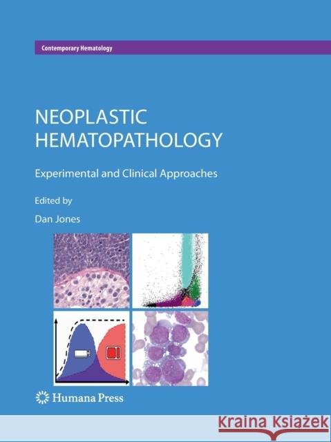 Neoplastic Hematopathology: Experimental and Clinical Approaches Jones, Dan 9781493957194 Humana Press