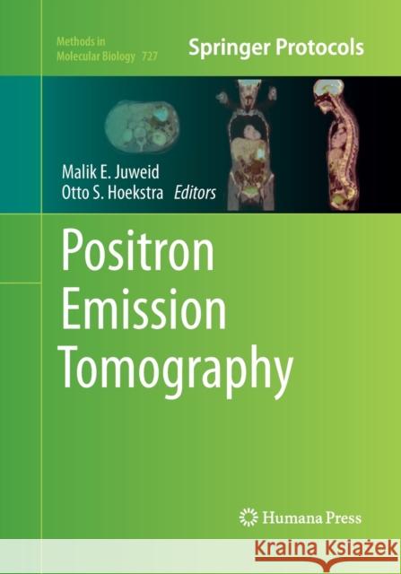 Positron Emission Tomography Malik E. Juweid Otto S. Hoekstra 9781493957378 Humana Press