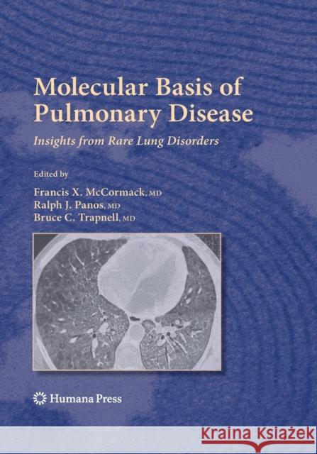 Molecular Basis of Pulmonary Disease: Insights from Rare Lung Disorders McCormack, Francis X. 9781493960811 Humana Press