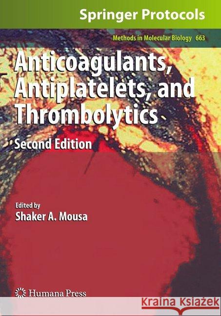 Anticoagulants, Antiplatelets, and Thrombolytics Shaker A. Mousa 9781493960972