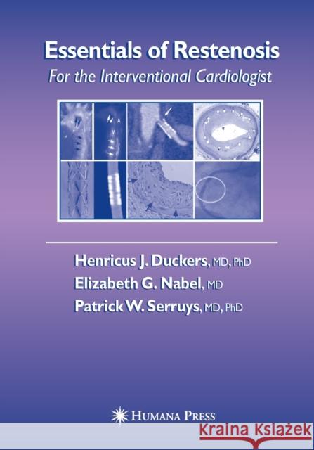 Essentials of Restenosis: For the Interventional Cardiologist Duckers, Henricus J. 9781493961108 Humana Press