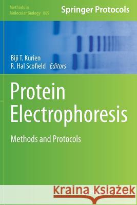 Protein Electrophoresis: Methods and Protocols Kurien, Biji T. 9781493962419 Humana Press