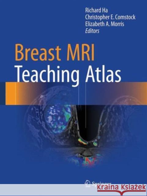 Breast MRI Teaching Atlas Richard Ha Elizabeth Morris 9781493964079