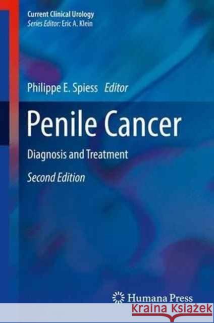 Penile Cancer: Diagnosis and Treatment Spiess, Philippe E. 9781493966776