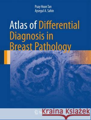 Atlas of Differential Diagnosis in Breast Pathology Puay Hoon Tan Aysegul A. Sahin 9781493966950 Springer