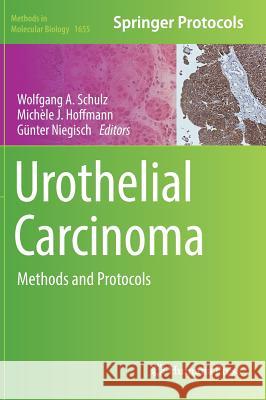 Urothelial Carcinoma: Methods and Protocols Schulz, Wolfgang A. 9781493972333