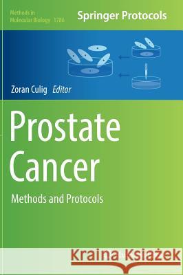 Prostate Cancer: Methods and Protocols Culig, Zoran 9781493978434 Humana Press