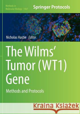 The Wilms' Tumor (Wt1) Gene: Methods and Protocols Hastie, Nicholas 9781493981564