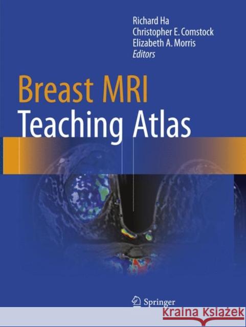 Breast MRI Teaching Atlas Richard Ha Christopher E. Comstock Elizabeth A. Morris 9781493981908 Springer