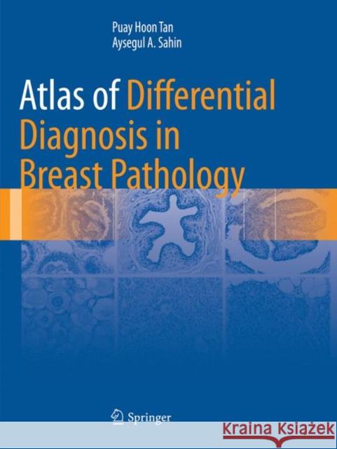 Atlas of Differential Diagnosis in Breast Pathology Puay Hoon Tan Aysegul A. Sahin 9781493982769 Springer