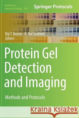 Protein Gel Detection and Imaging: Methods and Protocols Kurien, Biji T. 9781493987443 Humana Press