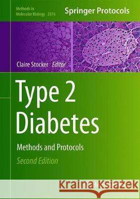 Type 2 Diabetes: Methods and Protocols Stocker, Claire J. 9781493998807 Humana