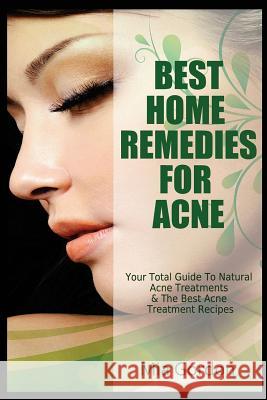Best Home Remedies For Acne: Your Total Guide To Natural Acne Treatments & The Best Acne Treatment Recipes Gordon, Mia 9781494245092 Createspace